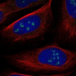 WDR36 Antibody, Novus Biologicals 0.1mL; Unlabeled:Antibodies, Polyclonal